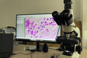 Nâng cấp kính hiển vi Olympus CX23 từ 2 mắt lên 3 mắt