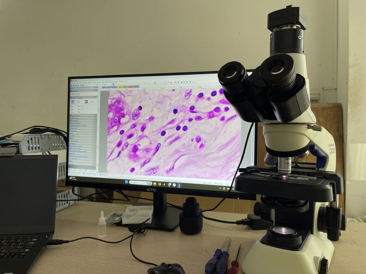 nâng cấp kinh cx23