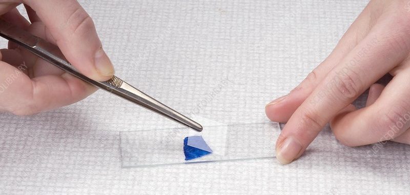 gắn lamen kính hiên vi giúp tăng na của hình ảnh