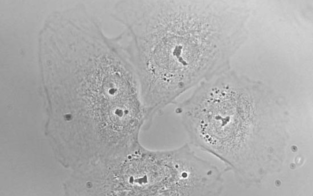 kỹ thuật tăng cường độ tương phản phase contrast