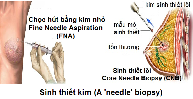 chuẩn đoán ung thư bằng kính hiển vi huỳnh quang