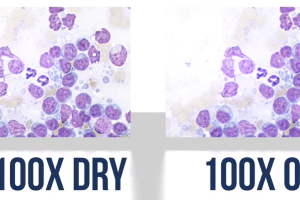 So sánh vật kính 100X/0.90 Dry và 100X/1.25 Oil