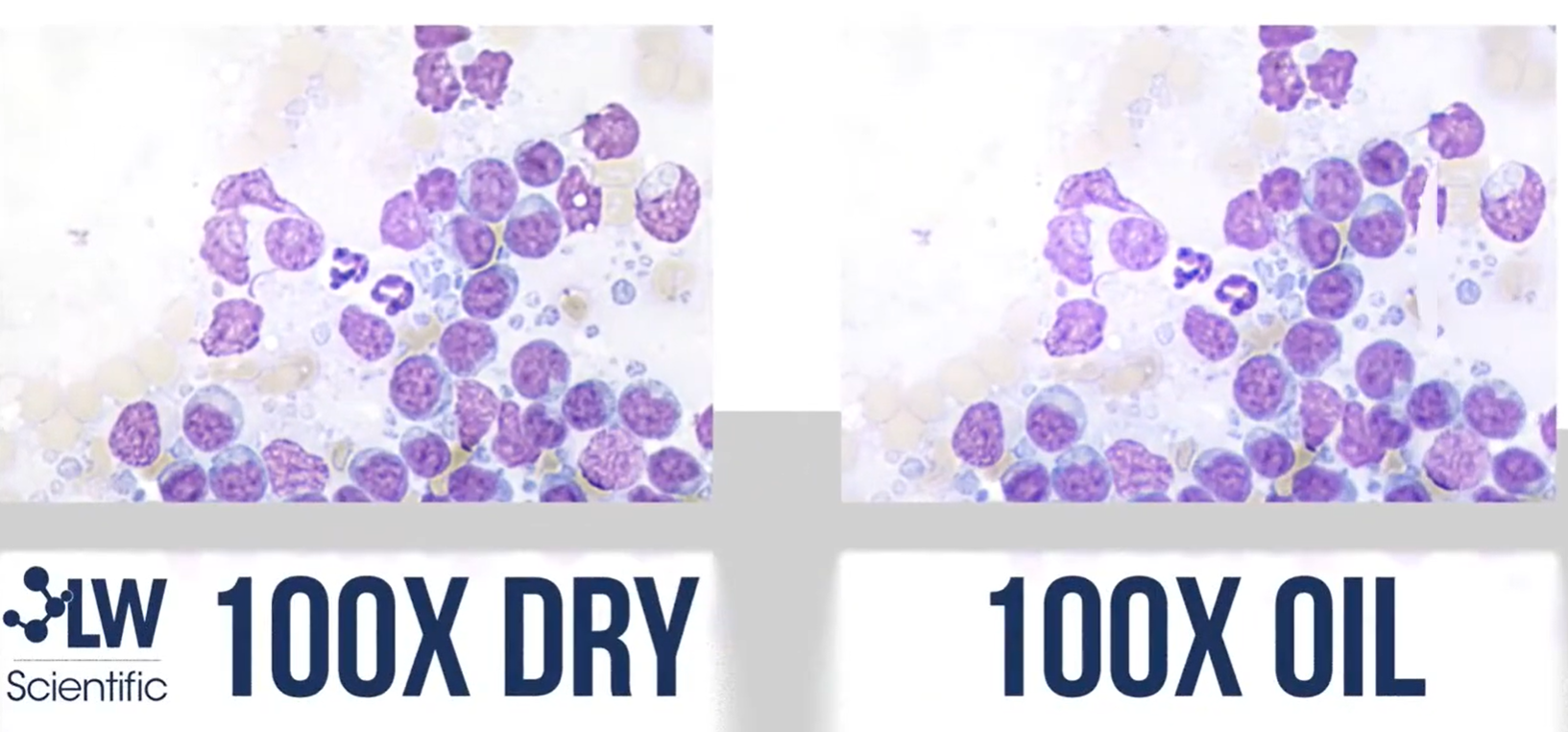 so sánh vật kính 100x oil và dry